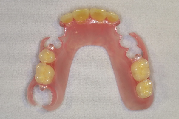 ゆう歯科クリニック・欠損補綴