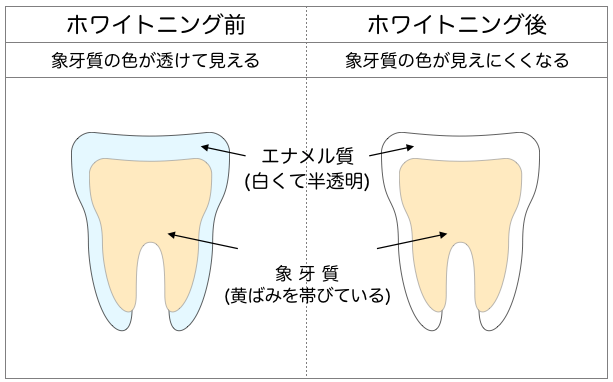 ゆう歯科クリニック ホワイトニング